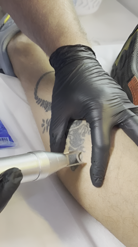 tatoo-1